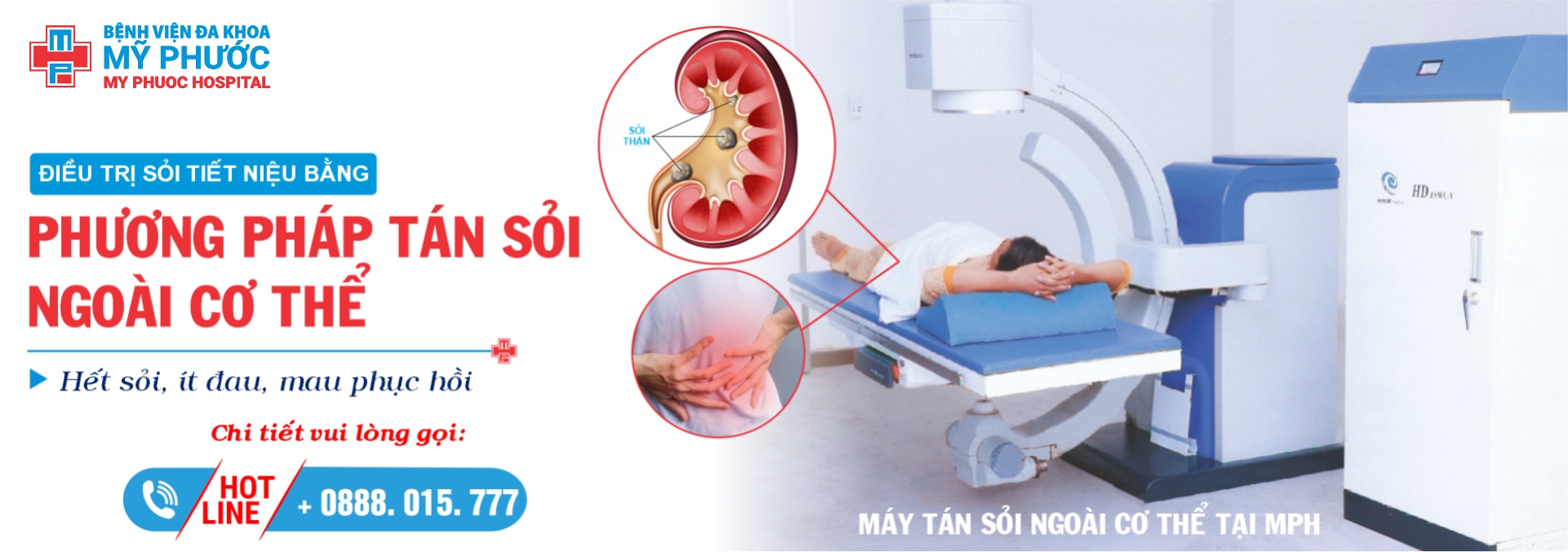 DỊCH VỤ TÁN SỎI NGOÀI CƠ THỂ